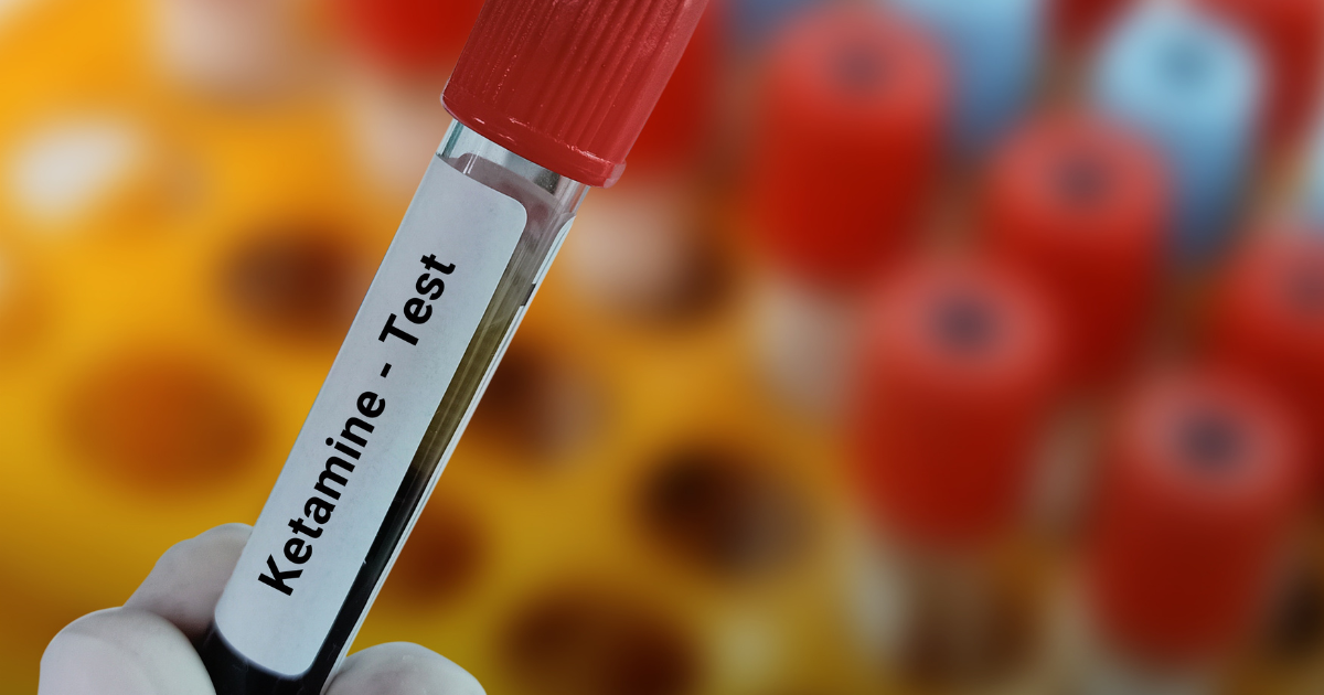 Ketamine-Assisted Psychotherapy