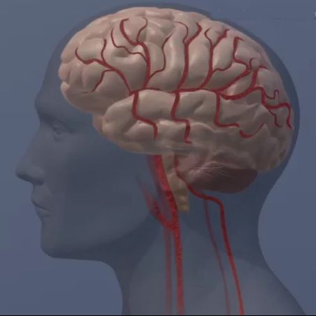 Cell Aging Marker Linked to Higher Risk of Brain Diseases, Study Finds
